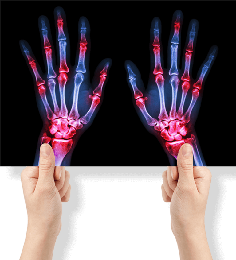 Rheumatology Clinic Springfield & Sinnamon Park Westside Rheumatology